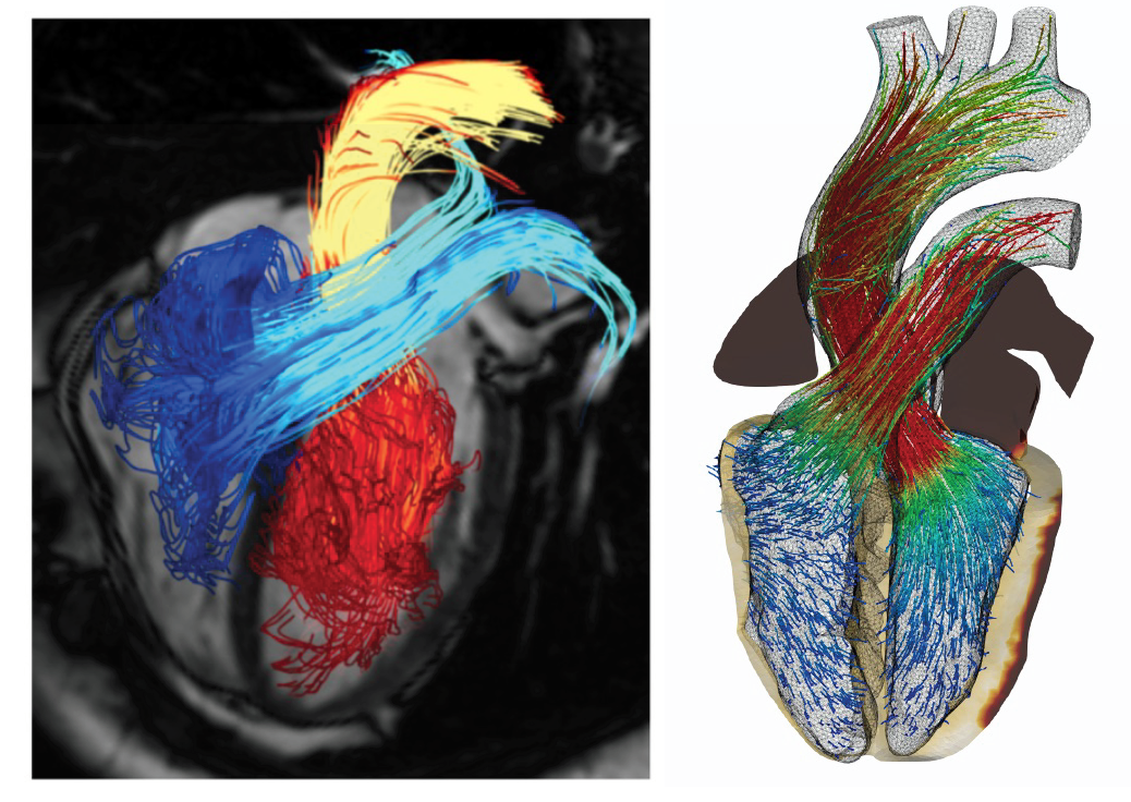 simulation_heartbeat_1.png