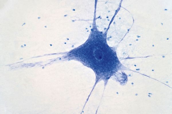 caixaresearch-institute-micrografias-12_p.jpg